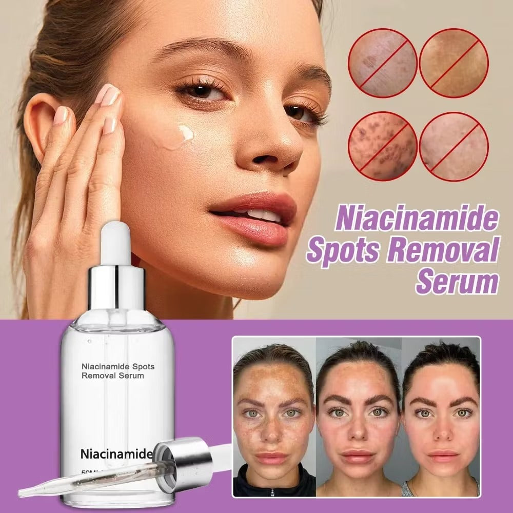 🎉Buy One Get One Free🔥Hot Sale 49% Off🎁 - 10% Niacinamide Spots Removal Serum