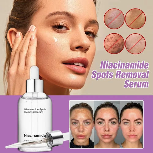 🎉Buy One Get One Free🔥Hot Sale 49% Off🎁 - 10% Niacinamide Spots Removal Serum