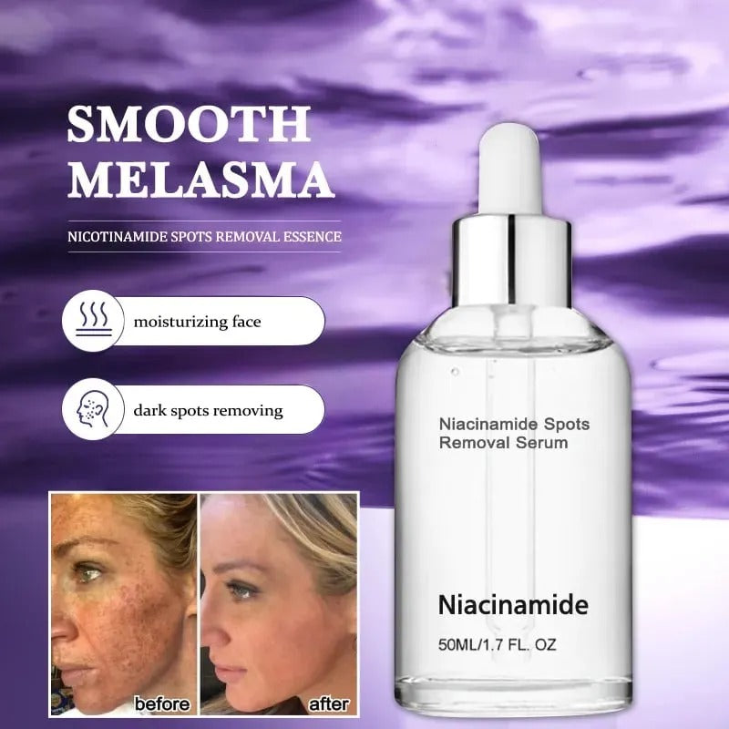 🎉Buy One Get One Free🔥Hot Sale 49% Off🎁 - 10% Niacinamide Spots Removal Serum