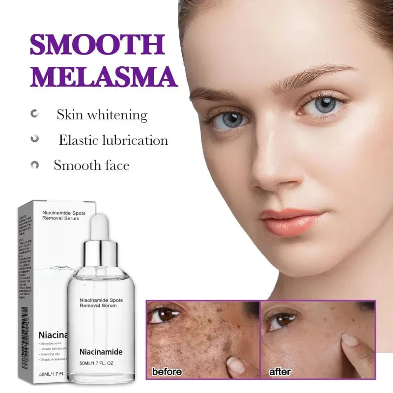 🎉Buy One Get One Free🔥Hot Sale 49% Off🎁 - 10% Niacinamide Spots Removal Serum