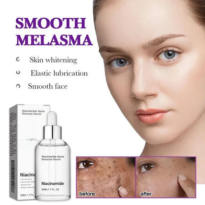 🎉Buy One Get One Free🔥Hot Sale 49% Off🎁 - 10% Niacinamide Spots Removal Serum