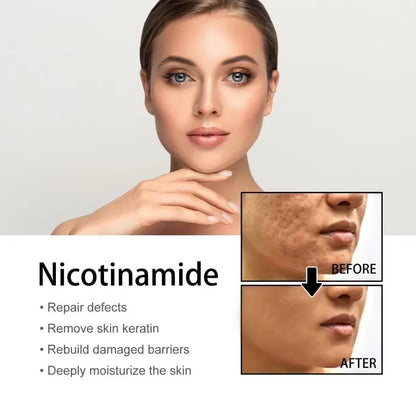 🎉Buy One Get One Free🔥Hot Sale 49% Off🎁 - 10% Niacinamide Spots Removal Serum