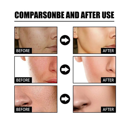 🎉Buy One Get One Free🔥Hot Sale 49% Off🎁 - 10% Niacinamide Spots Removal Serum