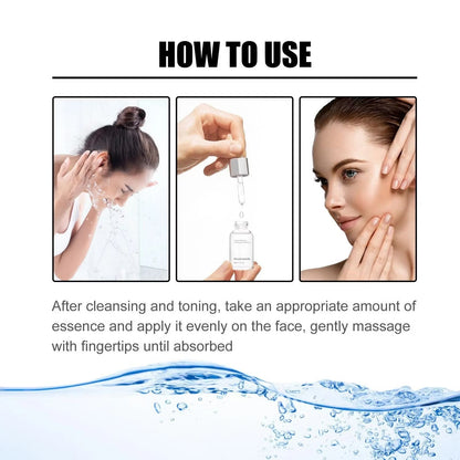 🎉Buy One Get One Free🔥Hot Sale 49% Off🎁 - 10% Niacinamide Spots Removal Serum